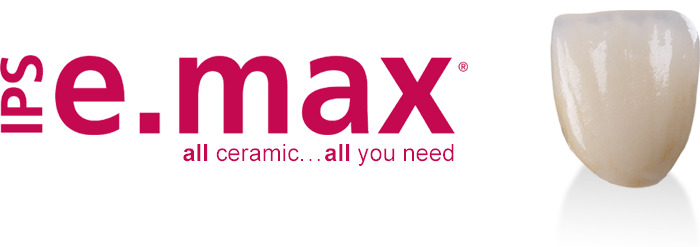 IPS e.max — technology and materials used at Top Dental Care